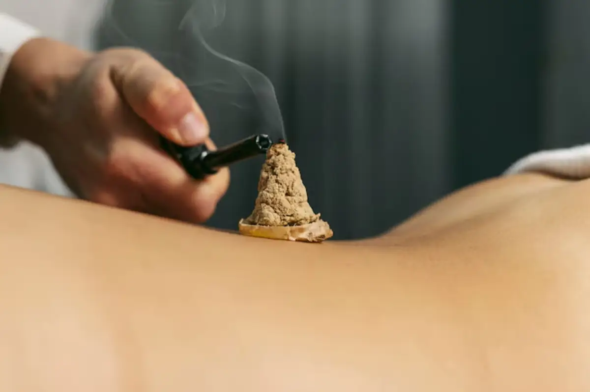 A hand holds a black instrument, lighting a cone of moxa on a person's lower back, with smoke rising in a therapeutic setting.