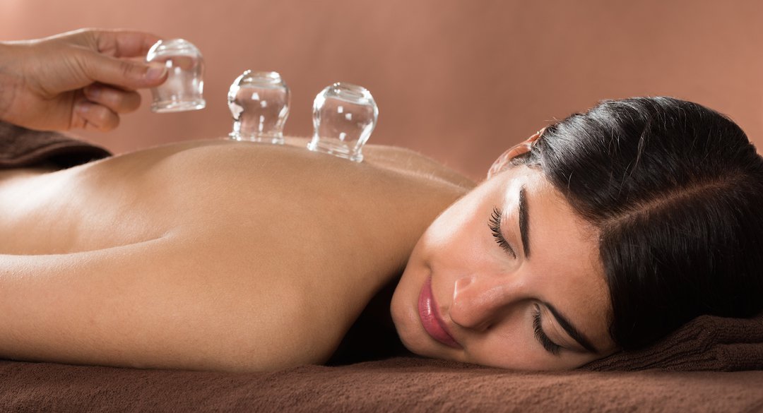 A person receiving cupping therapy, with glass cups placed on their back, promoting relaxation and pain relief in a spa setting.